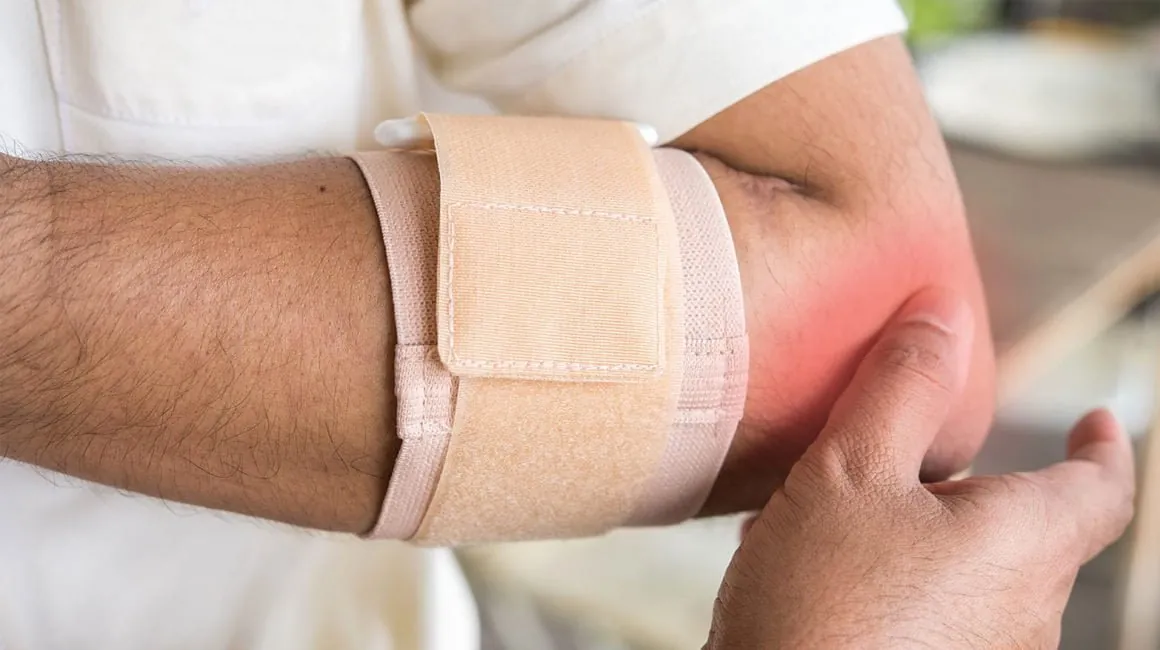 Elbow with pain on the outer side, typical of tennis elbow