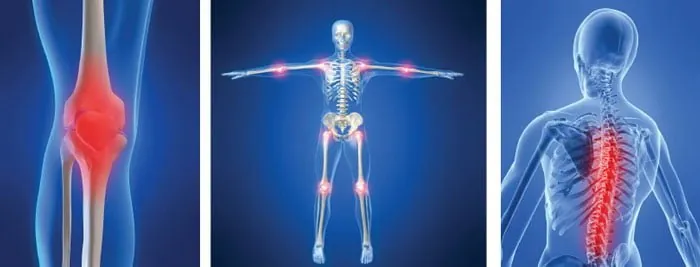 Illustration of knee, skeleton and spine, main areas of orthopedics